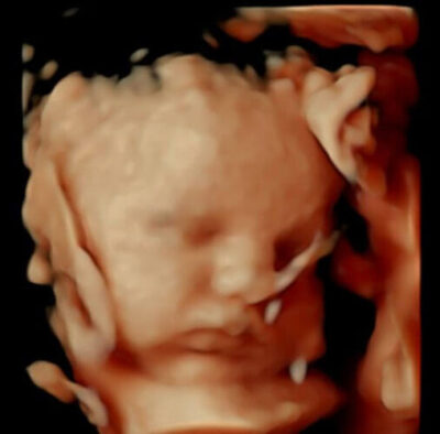 image of fetus on screen