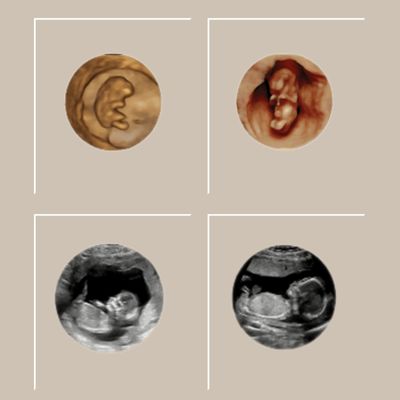 emllc logos and website graphics (100 x 100 px)